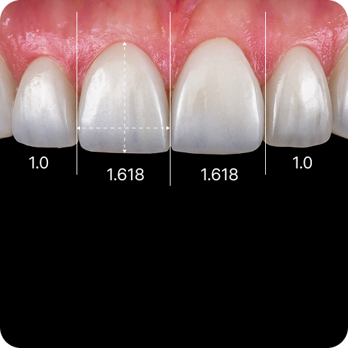 전치부 심미보철이란?