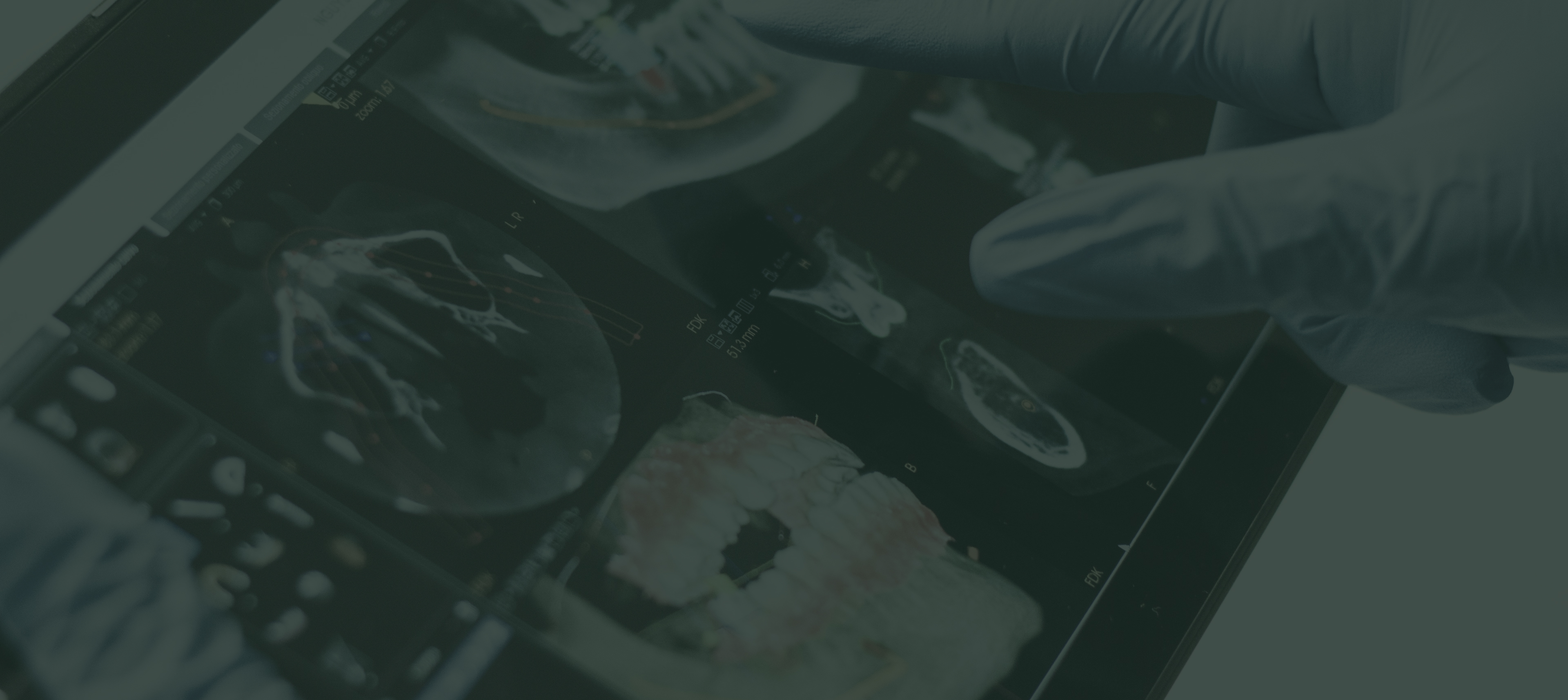 디지털 장비 치료